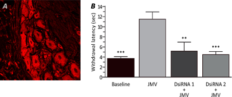 D-FG14RP-dsirna-F1 dcd13_YRdsirna_fig1A
