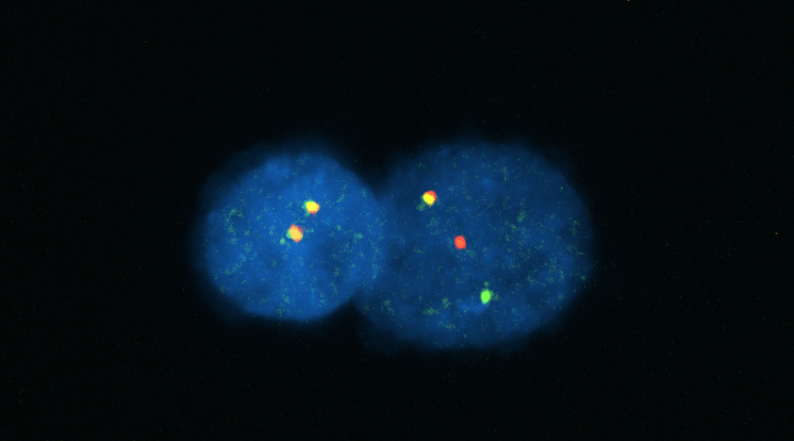 SB18RP-translocation-F3 SB18RP-translocation-F3