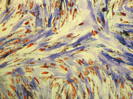 D-PCR11RP-identifyingstemcell-F1 yr_stemcell_fig1